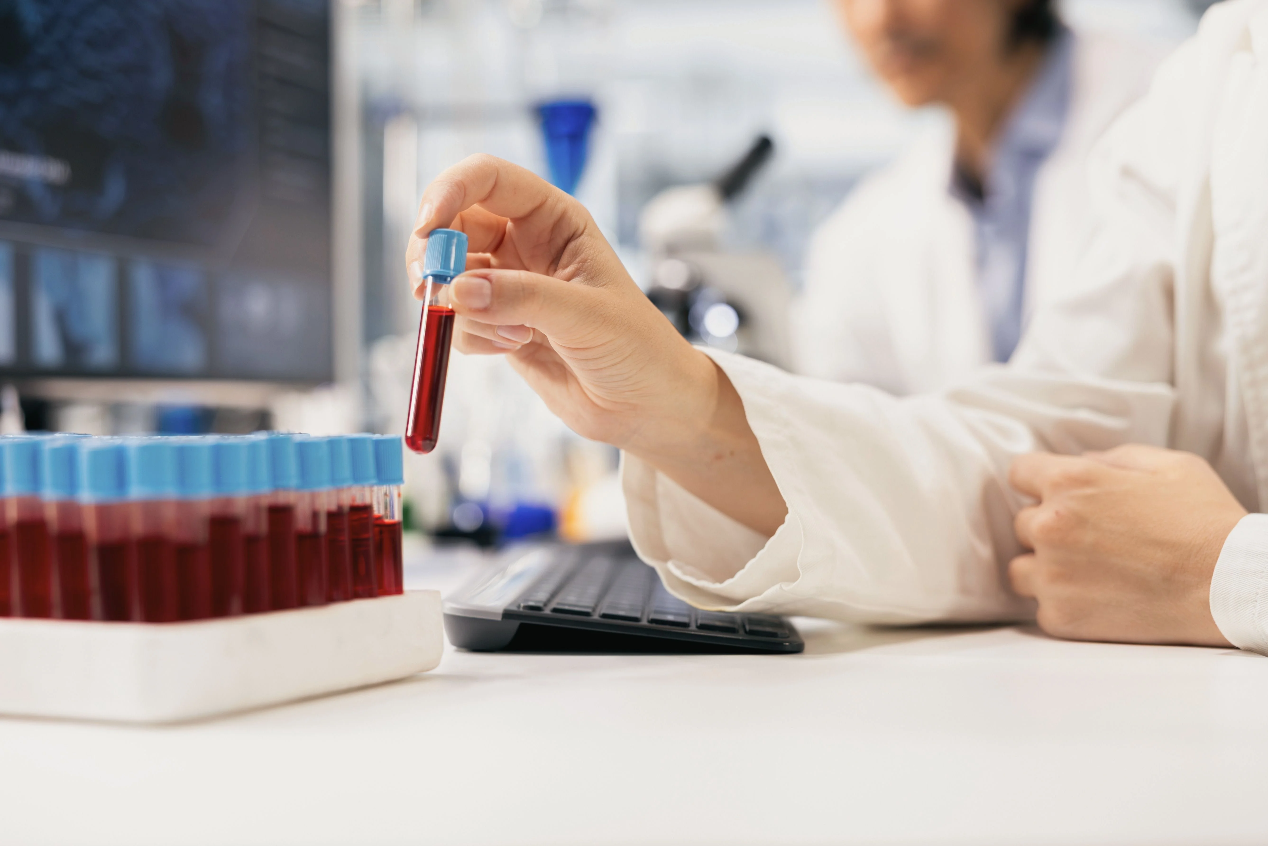 blood test in lab